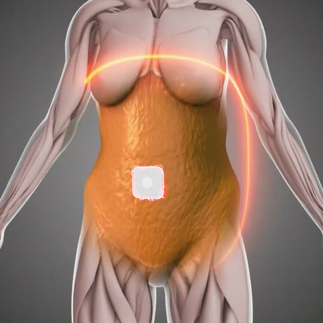 🔥 70% OFF | South Moon Slim & Burn Patch™