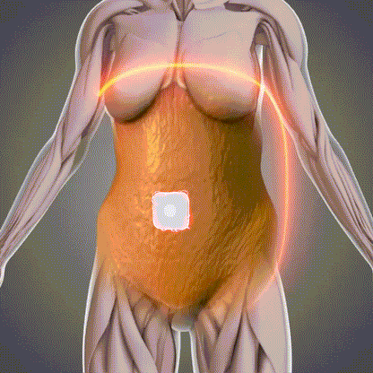 🔥 70% OFF | South Moon Slim & Burn Patch™